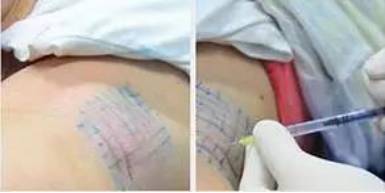 最后1天!保妥适全国大涨价,最低价仅限明天,手慢无!