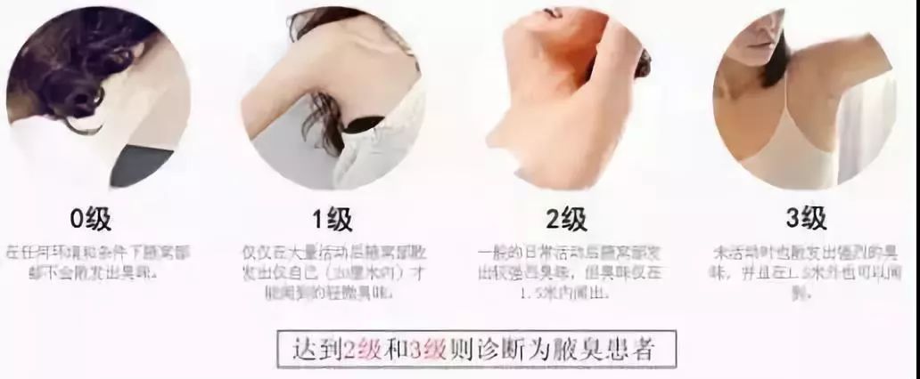 告别尴尬,这个夏季有品位没异味!