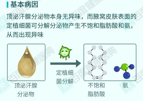告别狐臭 科学有效的解决方案与产品推荐